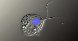 Trichomonas vaginalis kórokozó ( Differenciál interferencia kontraszt felvétel, sejtmag kékkel festve)